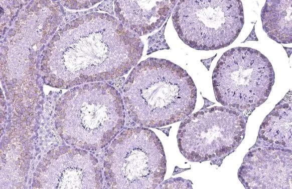 Immunohistochemistry-Paraffin: YTHDC2 Antibody (HL1862) - Azide and BSA Free [NBP3-25760] - YTHDC2 antibody [HL1862] detects YTHDC2 protein at cytoplasm by immunohistochemical analysis. Sample: Paraffin-embedded mouse testis. YTHDC2 stained by YTHDC2 antibody [HL1862] (NBP3-25760) diluted at 1:100. Antigen Retrieval: Citrate buffer, pH 6.0, 15 min