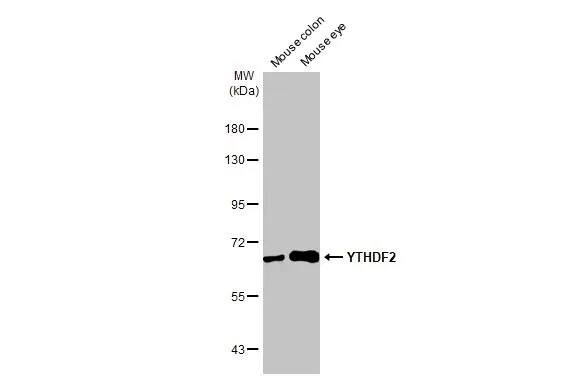 Western Blot: YTHDF2 Antibody (HL1354) - Azide and BSA Free [NBP3-25762] - Various tissue extracts (50 ug) were separated by 7.5% SDS-PAGE, and the membrane was blotted with YTHDF2 antibody [HL1354] (NBP3-25762) diluted at 1:1000. The HRP-conjugated anti-rabbit IgG antibody was used to detect the primary antibody.