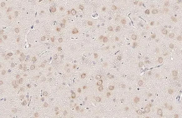 Immunohistochemistry-Paraffin: YTHDF3 Antibody (HL2235) - Azide and BSA Free [NBP3-25764] - YTHDF3 antibody [HL2235] detects YTHDF3 protein by immunohistochemical analysis. Sample: Paraffin-embedded rat brain. YTHDF3 stained by YTHDF3 antibody [HL2235] (NBP3-25764) diluted at 1:200. Antigen Retrieval: Citrate buffer, pH 6.0, 15 min