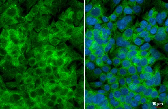 Immunocytochemistry/Immunofluorescence: YTHDF3 Antibody (HL2235) - Azide and BSA Free [NBP3-25764] - YTHDF3 antibody [HL2235] detects YTHDF3 protein at cytoplasm by immunofluorescent analysis. Sample: HepG2 cells were fixed in 4% paraformaldehyde at RT for 15 min. Green: YTHDF3 stained by YTHDF3 antibody [HL2235] (NBP3-25764) diluted at 1:500. Blue: Fluoroshield with DAPI .