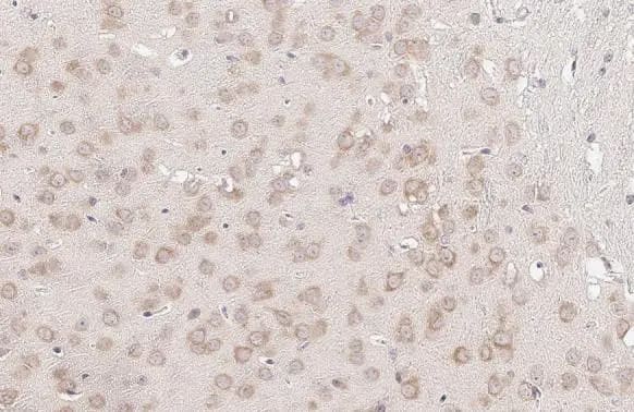 Immunohistochemistry-Paraffin YTHDF3 Antibody (HL2235) - Azide and BSA Free