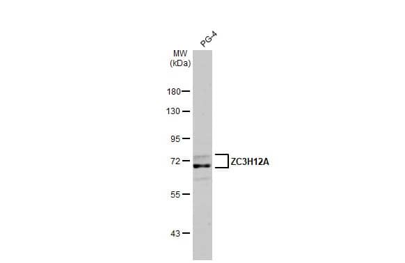 Western Blot: MCPIP1/ZC3H12A Antibody (HL1442) - Azide and BSA Free [NBP3-25765] - Whole cell extract (30 ug) was separated by 7.5% SDS-PAGE, and the membrane was blotted with ZC3H12A antibody [HL1442] (NBP3-25765) diluted at 1:1000. The HRP-conjugated anti-rabbit IgG antibody was used to detect the primary antibody, and the signal was developed with Trident ECL plus-Enhanced.