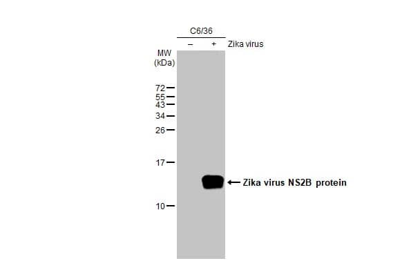 Western Blot: Zika virus NS2B Antibody (HL2151) - Azide and BSA Free [NBP3-25769] - Non-infected (-) and infected (+) C6/36 whole cell extracts (30 ug) were separated by 15% SDS-PAGE, and the membrane was blotted with Zika virus NS2B protein antibody [HL2151] (NBP3-25769) diluted at 1:5000. The HRP-conjugated anti-rabbit IgG antibody was used to detect the primary antibody.