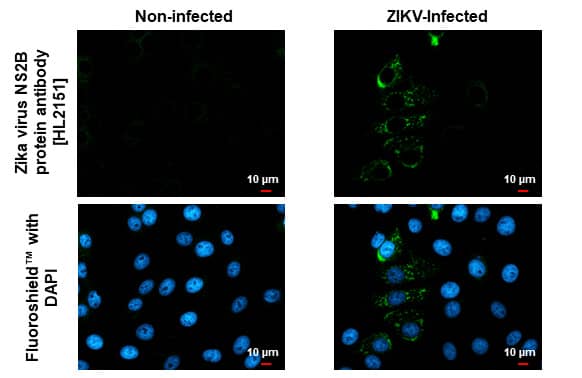 Immunocytochemistry/Immunofluorescence: Zika virus NS2B Antibody (HL2151) - Azide and BSA Free [NBP3-25769] - Immunofluorescent analysis of mock and Zika virus-infected cells using Zika virus NS2B protein antibody [HL2151] (NBP3-25769). Sample: Zika virus non-infected and infected cells slide. Green: Zika virus NS2B protein antibody [HL2151]antibody (NBP3-25769) diluted at 1:100. Blue: Fluoroshield with DAPI .
