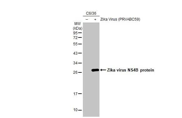 Western Blot: Zika virus NS4B Antibody (HL1663) - Azide and BSA Free [NBP3-25770] - Non-infected (-) and infected (+) C6/36 whole cell extracts (5 ug) were separated by 12% SDS-PAGE, and the membrane was blotted with Zika virus NS4B protein antibody [HL1663] (NBP3-25770) diluted at 1:1000. The HRP-conjugated anti-rabbit IgG antibody was used to detect the primary antibody.