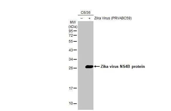Western Blot: Zika virus NS4B Antibody (HL1664) - Azide and BSA Free [NBP3-25771] - Non-infected (-) and infected (+) C6/36 whole cell extracts (5 ug) were separated by 12% SDS-PAGE, and the membrane was blotted with Zika virus NS4B protein antibody [HL1664] (NBP3-25771) diluted at 1:1000. The HRP-conjugated anti-rabbit IgG antibody was used to detect the primary antibody.