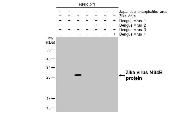 Non-infected (-) and infected (+) BHK-21 whole cell extracts (5 ug) were separated by 12% SDS-PAGE, and the membrane was blotted with Zika virus NS4B antibody [HL1664] (NBP3-25771) diluted at 1:1000. The HRP-conjugated anti-rabbit IgG antibody was used to detect the primary antibody. 
