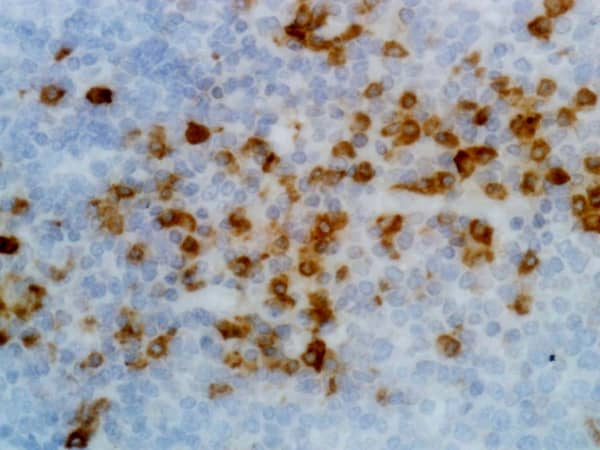 Immunohistochemistry-Paraffin: Kappa Light Chain Antibody (RM126) - Azide and BSA Free [NBP3-25965] - Immunohistochemistry of human tonsil using Clone RM126.