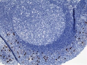 Immunohistochemistry-Paraffin: IgA2 Antibody (RM125) - Azide and BSA Free [NBP3-25971] - Immunohistochemistry of Human Tonsil Tissue using Clone RM125.