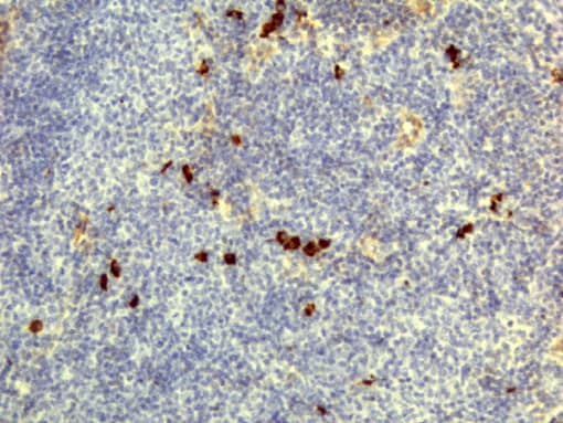 Immunohistochemistry-Paraffin: IgD Antibody (RM123) - Azide and BSA Free [NBP3-25972] - Immunohistochemistry of Human Lymphoid Tissue using Clone RM123.