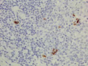 Immunohistochemistry-Paraffin: IgG3 Antibody (RM119) - Azide and BSA Free [NBP3-25976] - Immunohistochemistry of Human Lymphoid Tissue using Clone RM119.