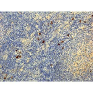 Immunohistochemistry-Paraffin: IgG4 Antibody (RM120) - Azide and BSA Free [NBP3-25977] - Immunohistochemistry of Human Lymphoid Tissue using Clone RM120.