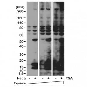 Western Blot: Acetyl-Lysine Antibody (RM101) - Azide and BSA Free [NBP3-25979] - Western blot of HeLa cells nontreated or treated with Trichostatin A (TSA), using Clone RM101 at 1/2000 dilution.