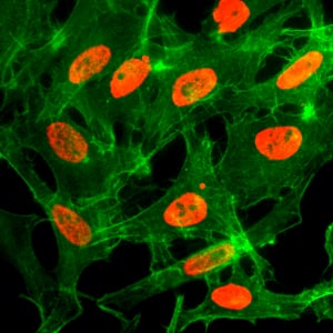 Immunocytochemistry/ Immunofluorescence: Histone H3 [ac Lys14] Antibody (RM130) - Azide and BSA Free [NBP3-25982] - Immunocytochemistry of HeLa cells treated with sodium butyrate, using Clone RM130 (red). Actin filaments have been labeled with fluorescein phalloidin (green).