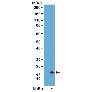Western Blot: Histone H3 [ac Lys14] Antibody (RM130) - Azide and BSA Free [NBP3-25982] - Western Blot of acid extracts from HeLa cells untreated (-) or treated with sodium butyrate (+) or, using RM130 at 0.5 ug/mL.