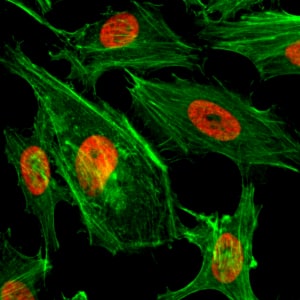 Immunocytochemistry/ Immunofluorescence: Histone H3 [Dimethyl Lys4] Antibody (RM135) - Azide and BSA Free [NBP3-25985] - Immunocytochemistry of HeLa cells treated with sodium butyrate, using Clone RM135 (red). Actin filaments have been labeled with fluorescein phalloidin (green).