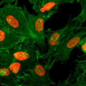 Immunocytochemistry/ Immunofluorescence: Histone H3 [ac Lys26] Antibody (RM154) - Azide and BSA Free [NBP3-25989] - Immunocytochemistry of HeLa cells treated with sodium butyrate, using Clone RM154 (red). Actin filaments have been labeled with fluorescein phalloidin (green).