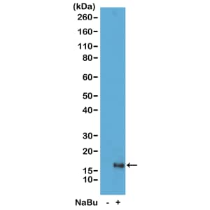 Western Blot: Histone H3 [ac Lys79] Antibody (RM156) - Azide and BSA Free [NBP3-25990] - Western Blot of acid extracts from HeLa cells untreated (-) or treated with Sodium Butyrate (+), using RM156 at 1 ug/mL.