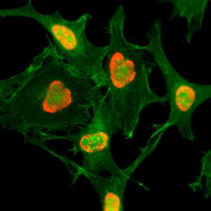 Immunocytochemistry/ Immunofluorescence: Histone H3 [ac Lys79] Antibody (RM156) - Azide and BSA Free [NBP3-25990] - Immunocytochemistry of HeLa cells treated with sodium butyrate, using Clone RM156 (red). Actin filaments have been labeled with fluorescein phalloidin (green).