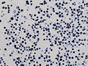 Immunohistochemistry-Paraffin: Histone H3 [ac Lys9] Antibody (RM161) - Azide and BSA Free [NBP3-25994] - Immunohistochemistry staining of HepG2 cells using Clone RM161.