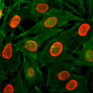 Immunocytochemistry/ Immunofluorescence: Histone H3 [ac Lys9] Antibody (RM161) - Azide and BSA Free [NBP3-25994] - Immunocytochemistry of HeLa cells treated with sodium butyrate, using Clone RM161 (red). Actin filaments have been labeled with fluorescein phalloidin (green).