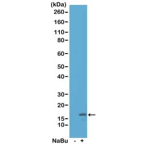 Western Blot: Histone H3 [ac Lys18] Antibody (RM166) - Azide and BSA Free [NBP3-25995] - Western Blot of acid extracts from HeLa cells untreated (-) or treated (+) with sodium butyrate, using RM166 at 0.5 ug/mL.