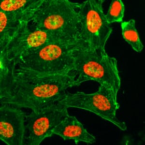 Immunocytochemistry/ Immunofluorescence: Histone H3 [ac Lys18] Antibody (RM166) - Azide and BSA Free [NBP3-25995] - Immunocytochemistry of HeLa cells treated with sodium butyrate, using Clone RM166 (red). Actin filaments have been labeled with fluorescein phalloidin (green).