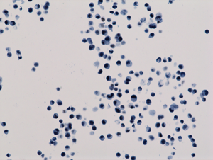 Immunohistochemistry-Paraffin: Histone H3 [ac Lys18] Antibody (RM166) - Azide and BSA Free [NBP3-25995] - Immunohistochemistry staining of HepG2 cells using Clone RM166.