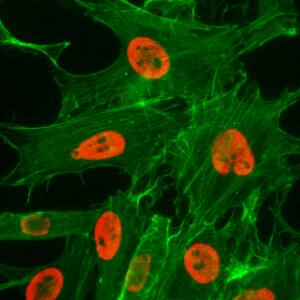 Immunocytochemistry/ Immunofluorescence: Histone H3 [ac Lys27] Antibody (RM172) - Azide and BSA Free [NBP3-25996] - Immunocytochemistry of HeLa cells treated with sodium butyrate, using Clone RM172 (red). Actin filaments have been labeled with fluorescein phalloidin (green).