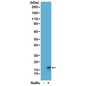 Western Blot: Histone H3 [ac Lys27] Antibody (RM172) - Azide and BSA Free [NBP3-25996] - Western Blot of acid extracts from HeLa cells untreated (-) or treated (+) with sodium butyrate, using RM172 at 1 ug/mL, showed a band of histone H3 acetylated at Lysine 27 in treated HeLa.