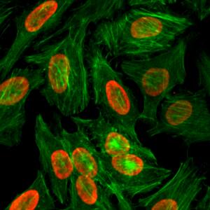 Immunocytochemistry/ Immunofluorescence: Histone H3 [Dimethyl Lys9] Antibody (RM151) - Azide and BSA Free [NBP3-25998] - Immunocytochemistry of HeLa cells treated with sodium butyrate, using Clone RM151 (red). Actin filaments have been labeled with fluorescein phalloidin (green).