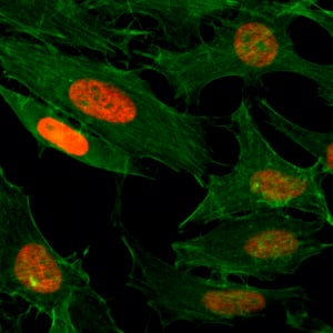 Immunocytochemistry/ Immunofluorescence: Histone H3 [ac Lys4] Antibody (RM149) - Azide and BSA Free [NBP3-26000] - Immunocytochemistry of HeLa cells treated with sodium butyrate, using Clone RM149 (red). Actin filaments have been labeled with fluorescein phalloidin (green).