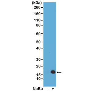 Western Blot: Histone H3 [ac Lys4] Antibody (RM149) - Azide and BSA Free [NBP3-26000] - Western Blot of acid extracts from HeLa cells untreated (-) or treated (+) with sodium butyrate, using RM149 at 0.5 ug/mL, showed a band of Histone H3 acetylated at Lysine 4 in treated HeLa.