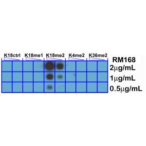 Dot Blot: Histone H3 [Dimethyl Lys18] Antibody (RM168) - Azide and BSA Free [NBP3-26003] - A Peptide dotblot shows RM168 only reacts to Histone. H3 dimethyl-Lysine 18 (K18me2). No cross reactivity with nonmodified Lysine 18 (K18Ctrl), monomethylated. Lysine 18 (K18me1), dimethylated Lysine 4 (K4me2),.or dimethylated Lysine 36 (K36me2).
