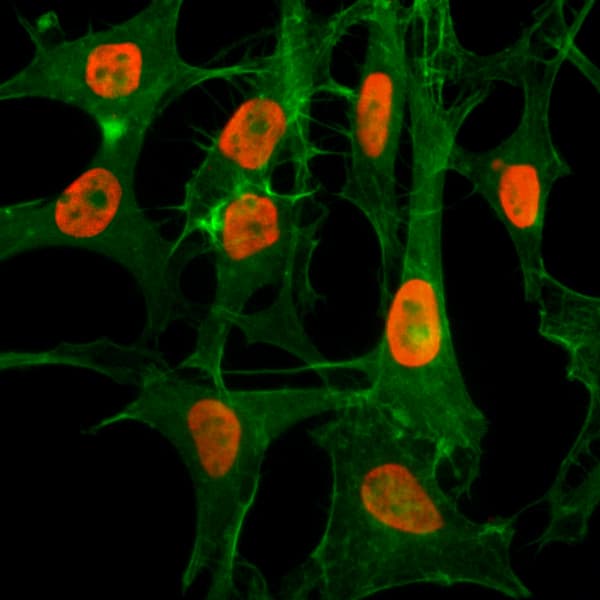 Immunocytochemistry/ Immunofluorescence: Histone H3 [ac Lys56] Antibody (RM179) - Azide and BSA Free [NBP3-26007] - Immunocytochemistry of HeLa cells treated with sodium butyrate, using Clone RM179 (red). Actin filaments have been labeled with fluorescein phalloidin (green).