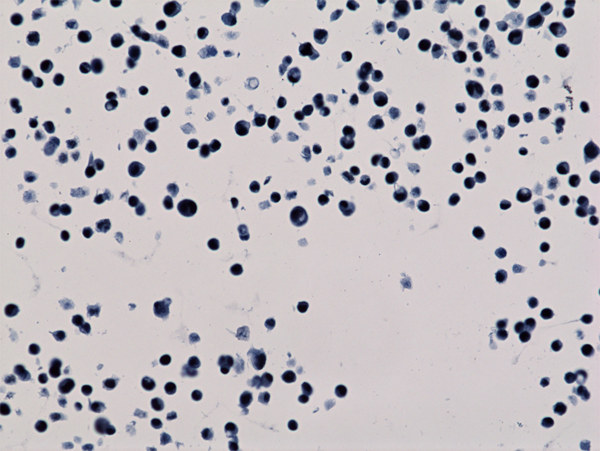 Immunohistochemistry-Paraffin: Histone H3 [ac Lys56] Antibody (RM179) - Azide and BSA Free [NBP3-26007] - Immunohistochemistry staining of HepG2 cells using Clone RM179.