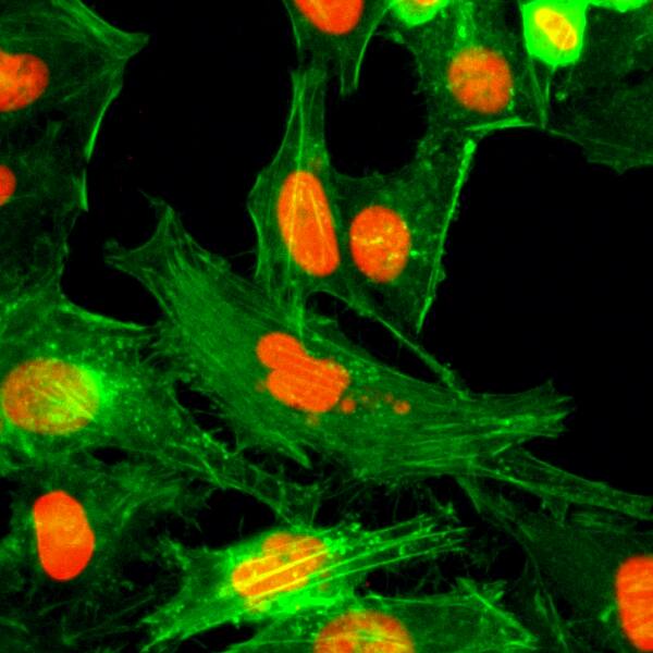 Immunocytochemistry/ Immunofluorescence: Histone H4 [Monomethyl Arg3] Antibody (RM195) - Azide and BSA Free [NBP3-26009] - Immunocytochemical staining of HeLa cells using Clone RM195 (red). Actin filaments have been labeled with fluorescein phalloidin (green).