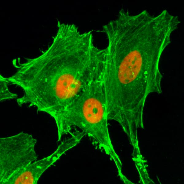 Immunocytochemistry/ Immunofluorescence: Histone H4 [ac Lys20] Antibody (RM205) - Azide and BSA Free [NBP3-26013] - Immunocytochemical staining of HeLa cells treated with sodium butyrate, using Clone RM205 (red). Actin filaments have been labeled with fluorescein phalloidin (green).