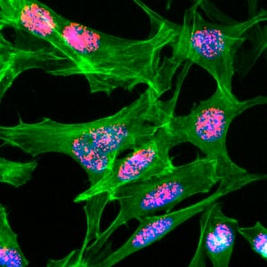 Immunocytochemistry/ Immunofluorescence: Histone H3 [ac Lys23] Antibody (RM169) - Azide and BSA Free [NBP3-26015] - Immunocytochemical staining of HeLa cells treated with sodium butyrate, using Clone RM169 (red). Actin filaments have been labeled with fluorescein phalloidin (green), and nuclei stained with DAPI (blue).