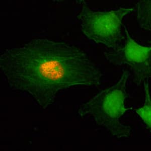 Immunocytochemistry/ Immunofluorescence: Histone H2AE [p Ser1] Antibody (RM216) - Azide and BSA Free [NBP3-26017] - Immunocytochemistry of HeLa cells, using Clone RM216 (red). Actin filaments have been labeled with fluorescein phalloidin (green).