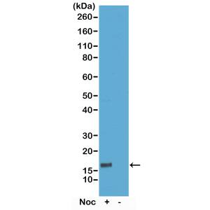 Western Blot: Histone H3 [p Thr6] Antibody (RM160) - Azide and BSA Free [NBP3-26020] - Western Blot of acid extracts of HeLa cells treated or non-treated with Nocodazole, using RM160 at 0.1 ug/mL, showed a band of Histone H3 phosphorylated at threonine 6 in HeLa cells.