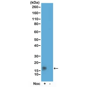 Western Blot: Histone H3 [p Thr11] Antibody (RM164) - Azide and BSA Free [NBP3-26021] - Western Blot of acid extracts of HeLa cells treated or non-treated with Nocodazole, using RM164 at 0.5 ug/mL, showed a band of Histone H3 phosphorylated at threonine 11 in HeLa cells.