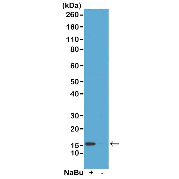Western Blot: Histone H2A.Z [ac Lys4] Antibody (RM221) - Azide and BSA Free [NBP3-26025] - Western Blot of acid extracts from HeLa cells treated (+) or untreated (-) with sodium butyrate, using Clone RM221 at 0.5 ug/mL.