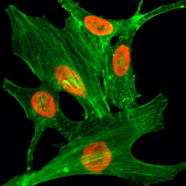 Immunocytochemistry/ Immunofluorescence: Histone H2A.Z [ac Lys4] Antibody (RM221) - Azide and BSA Free [NBP3-26025] - Immunocytochemical staining of HeLa cells treated with sodium butyrate, using Clone RM221 (red). Actin filaments have been labeled with fluorescein phalloidin (green).