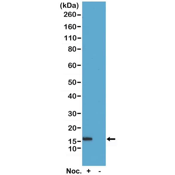 Western Blot: Histone H2B type 1B [p Ser14] Antibody (RM238) - Azide and BSA Free [NBP3-26029] - Western Blot of acid extracts of HeLa cells treated or non-treated with Nocodazole, using RM238 at 0.5 ug/mL, showed a band of Histone H2B phosphorylated at Serine 14 in HeLa cells.