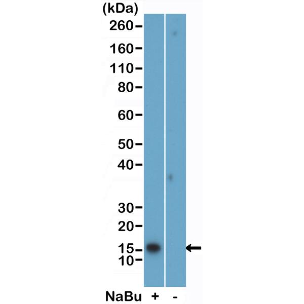 Western Blot: Histone H2B [ac Lys5] Antibody (RM455) - Azide and BSA Free [NBP3-26034] - Western Blot of acid extracts of HeLa cells treated (+) or untreated (-) with sodium butyrate, using Clone RM455 at 0.02 ug/mL.