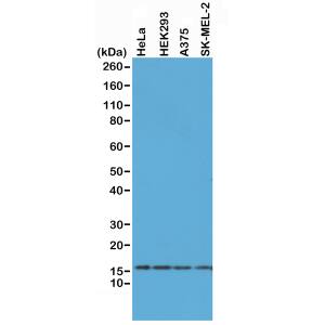 Western Blot: Histone H2AX Antibody (RM214) - Azide and BSA Free [NBP3-26044] - Western Blot of HeLa, HEK293, A375, and SK-MEL-2 whole cell lysates, using RM214 at 0.5 ug/mL, showed endogenous Histone H2AX in HeLa, HEK293, A375, and SK-MEL-2 cells.
