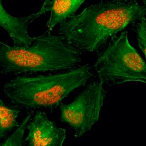 Immunocytochemistry/ Immunofluorescence: Histone H2AX Antibody (RM214) - Azide and BSA Free [NBP3-26044] - Immunocytochemistry of HeLa cells, using Clone RM214 (red). Actin filaments have been labeled with fluorescein phalloidin (green).