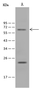 Western Blot Cardiac Leiomodin Antibody - Azide and BSA Free