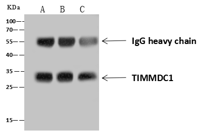 Immunoprecipitation: TIMMDC1 Antibody - Azide and BSA Free [NBP3-26071] - TIMMDC1 was immunoprecipitated using: Lane A: 0.5 mg THP1 Whole Cell Lysate. Lane B: 0.5 mg A375 Whole Cell Lysate. Lane C: 0.5 mg HepG2 Whole Cell Lysate 4 uL NBP3-26071 and 60 ug of Immunomagnetic beads Protein A/G. Primary antibody: NBP3-26071, at 1:100 dilution. Secondary antibody: Goat Anti-Rabbit IgG (H+L) [HRP] at 1/10000 dilution. Developed using the ECL technique. Performed under reducing conditions. Predicted band size: 32 kDa. Observed band size: 32 kDa